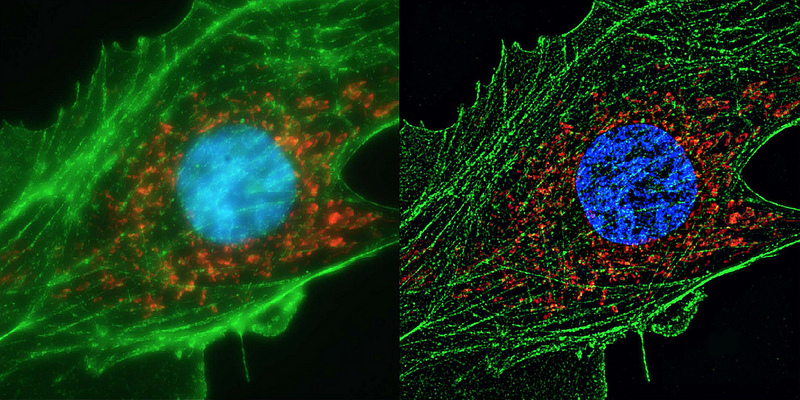 Human cell super resolution by ZEISS Microscopy